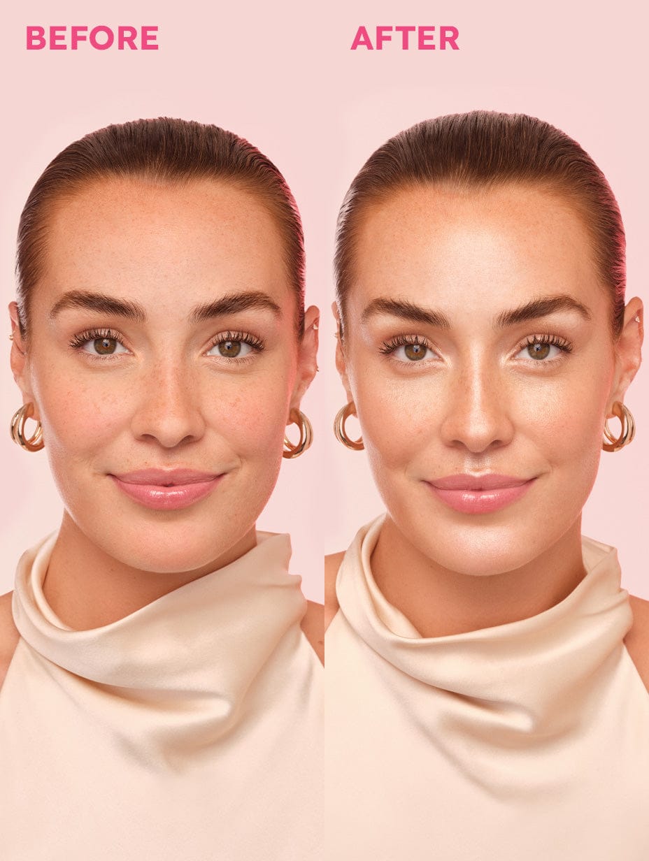 Mini LoveBeam® Perfector - Image 3